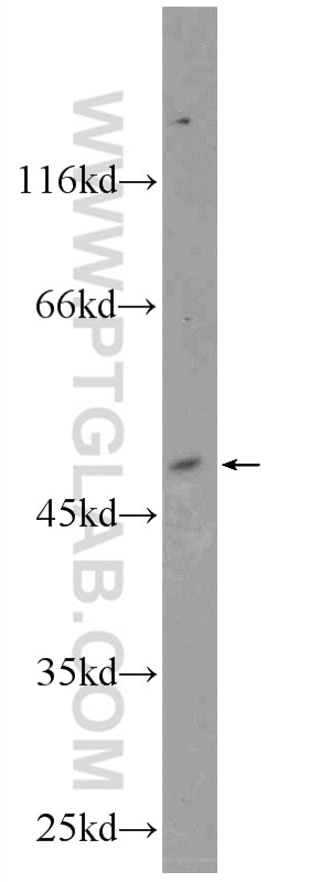 Western Blot (WB) analysis of A375 cells using KCNK18 Polyclonal antibody (23712-1-AP)