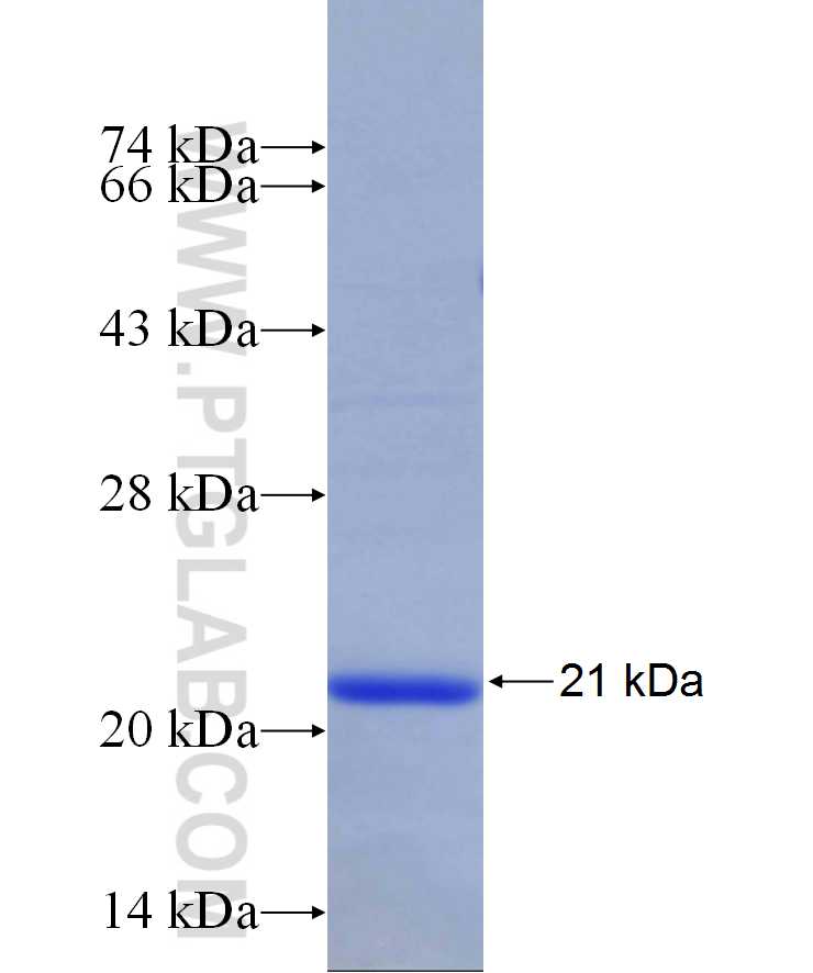 KCNK3 fusion protein Ag29689 SDS-PAGE KCNK3 fusion protein Ag29689 SDS-PAGE