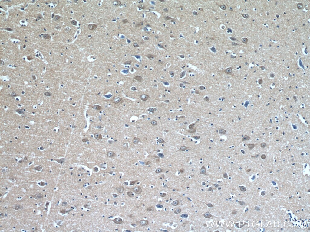 IHC staining of human brain using 27113-1-AP