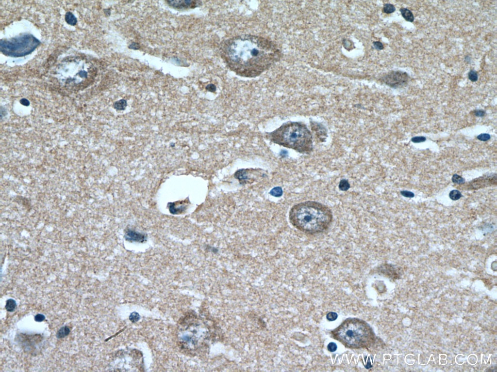 Immunohistochemistry (IHC) staining of human brain tissue using KCNK4 Polyclonal antibody (27113-1-AP)