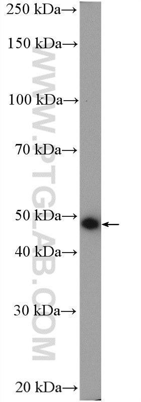 Western Blot (WB) analysis of mouse eye tissue using KCNK4 Polyclonal antibody (27113-1-AP)