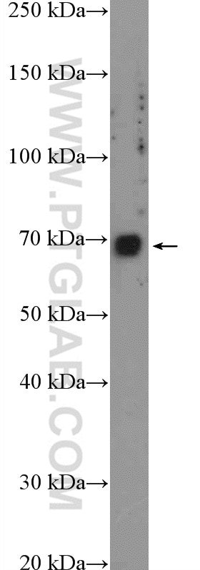 Western Blot (WB) analysis of HEK-293 cells using KCNK5 Polyclonal antibody (14136-1-AP)