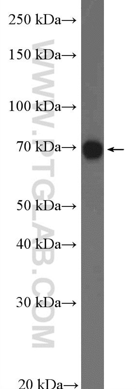 Western Blot (WB) analysis of HepG2 cells using KCNK5 Polyclonal antibody (14136-1-AP)