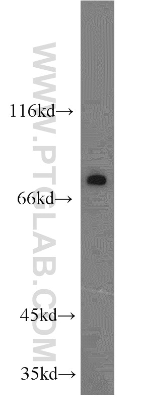 Western Blot (WB) analysis of PC-3 cells using KCNK5 Polyclonal antibody (14136-1-AP)