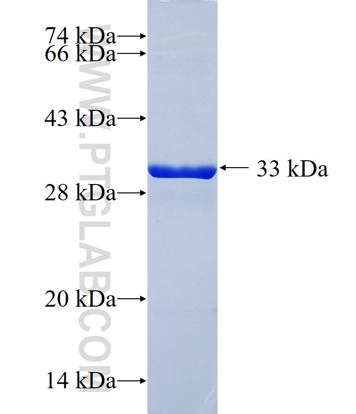 KCNK7 fusion protein Ag15894 SDS-PAGE KCNK7 fusion protein Ag15894 SDS-PAGE