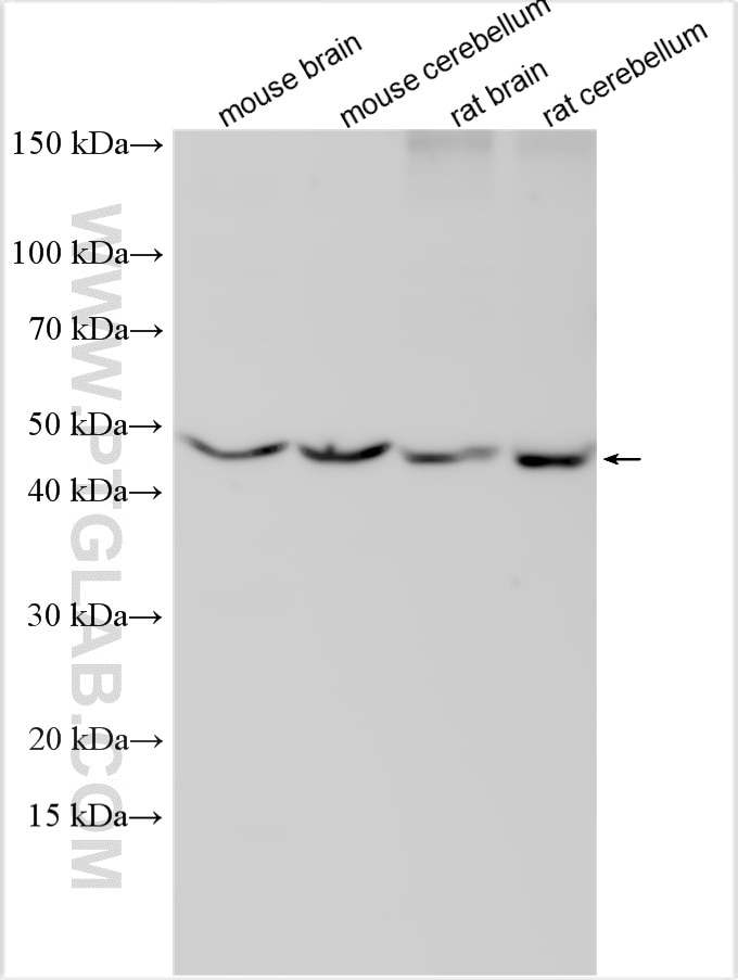 Western Blot (WB) analysis of various lysates using KCNK9 Polyclonal antibody (18033-1-AP)