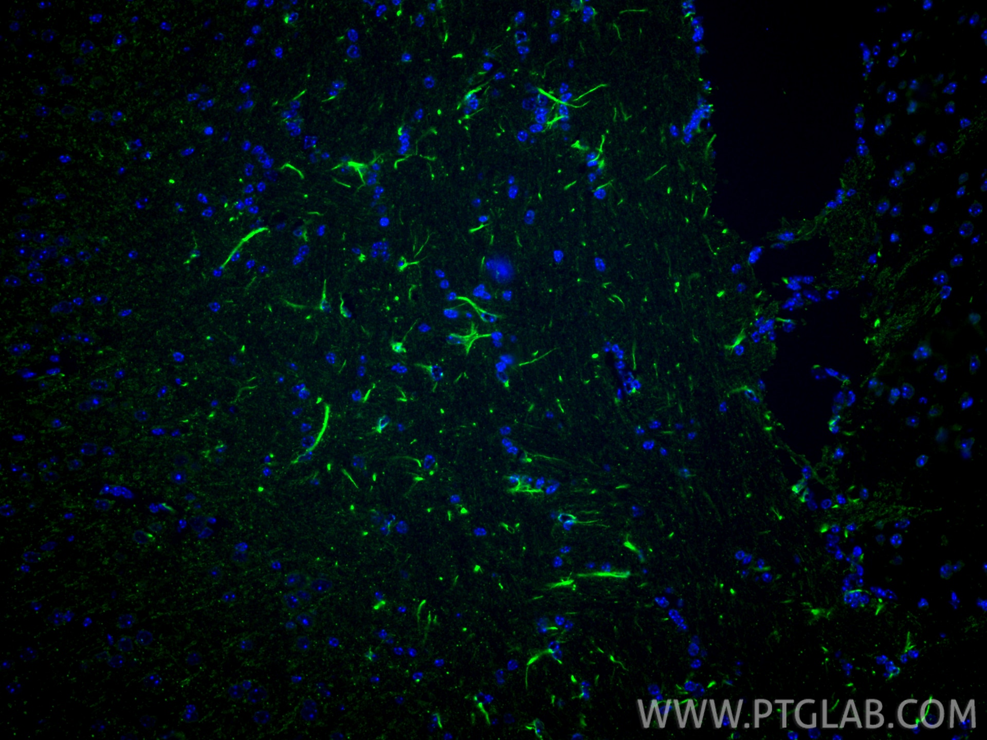 Immunofluorescence (IF) / fluorescent staining of mouse brain tissue using KCNMA1 Polyclonal antibody (22158-1-AP)
