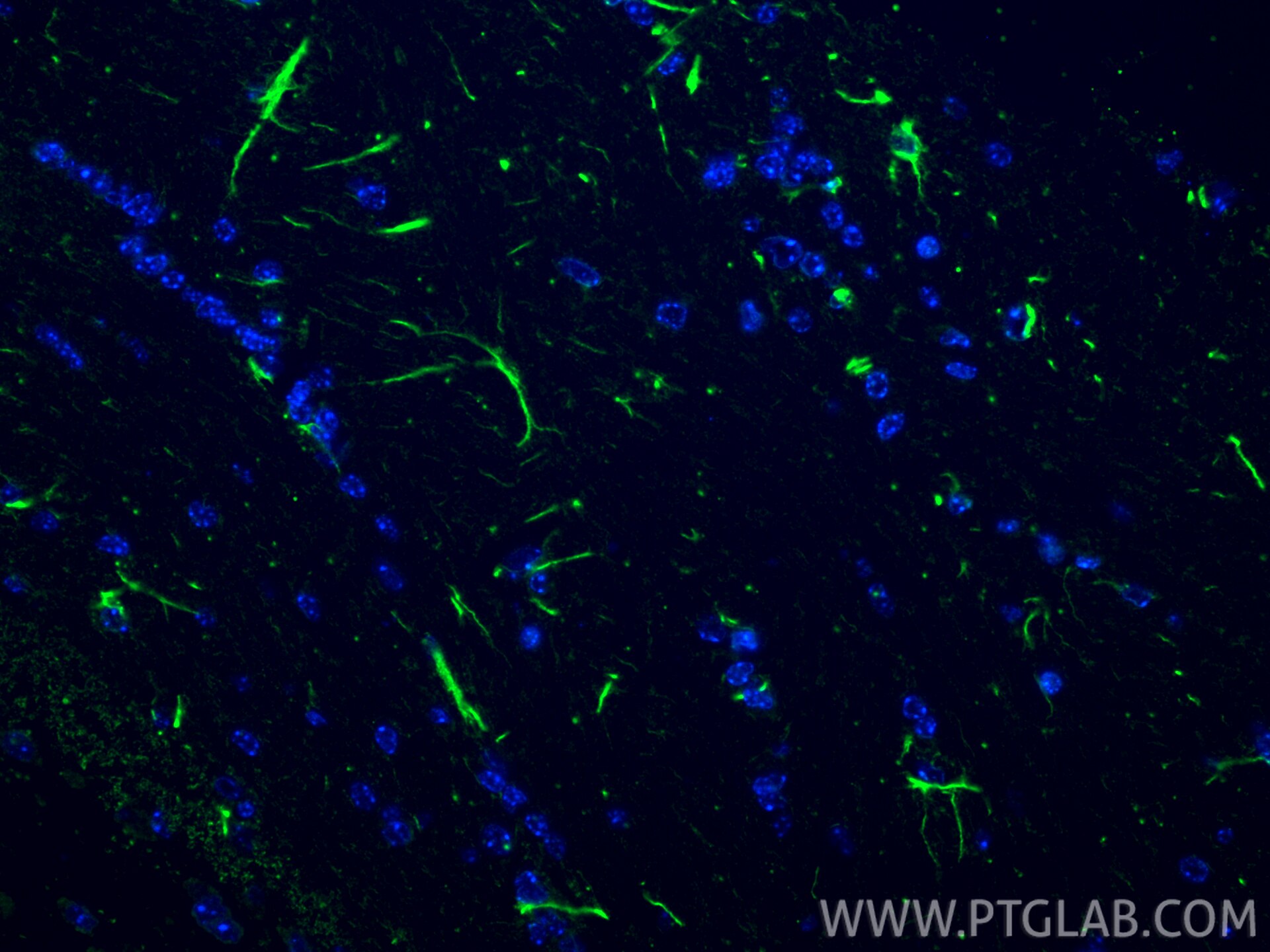 Immunofluorescence (IF) / fluorescent staining of mouse brain tissue using KCNMA1 Polyclonal antibody (22158-1-AP)