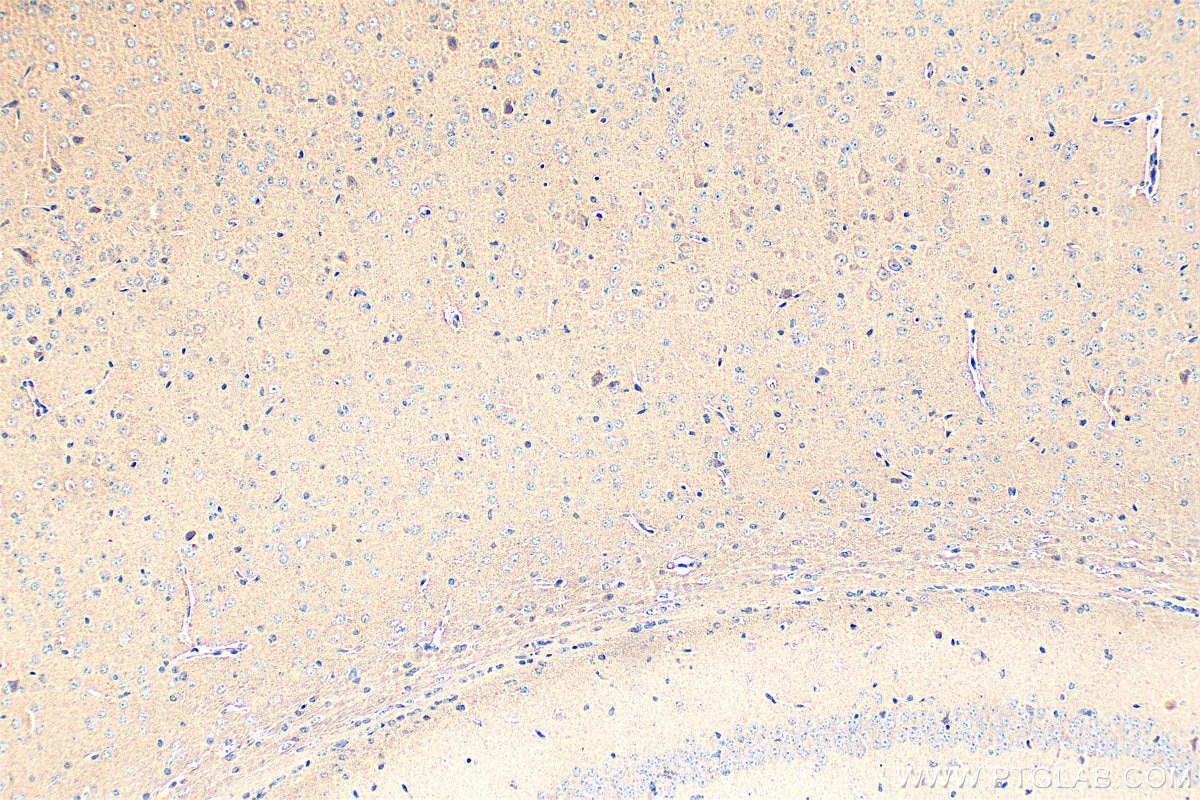 Immunohistochemistry (IHC) staining of mouse brain tissue using KCNMA1 Polyclonal antibody (22158-1-AP)