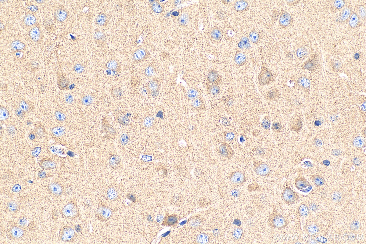 Immunohistochemistry (IHC) staining of mouse brain tissue using KCNMA1 Polyclonal antibody (22158-1-AP)