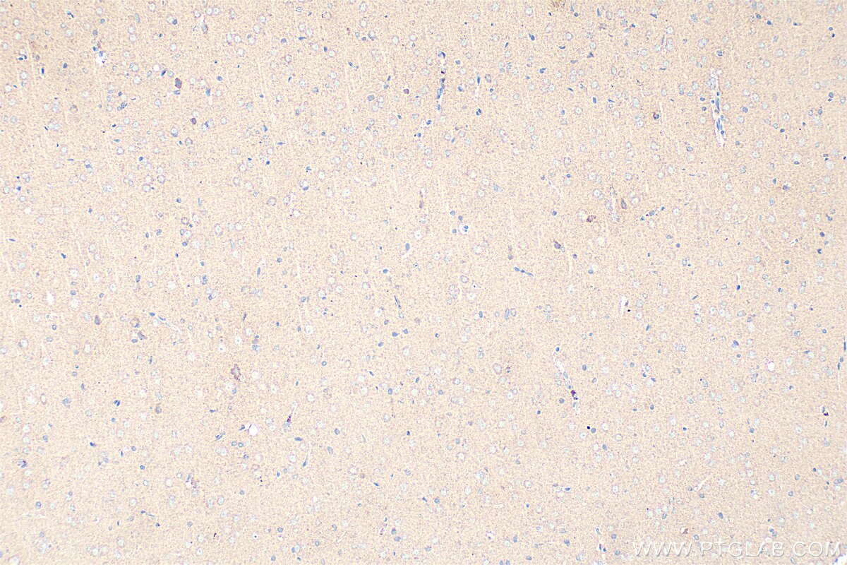 Immunohistochemistry (IHC) staining of rat brain tissue using KCNMA1 Polyclonal antibody (22158-1-AP)