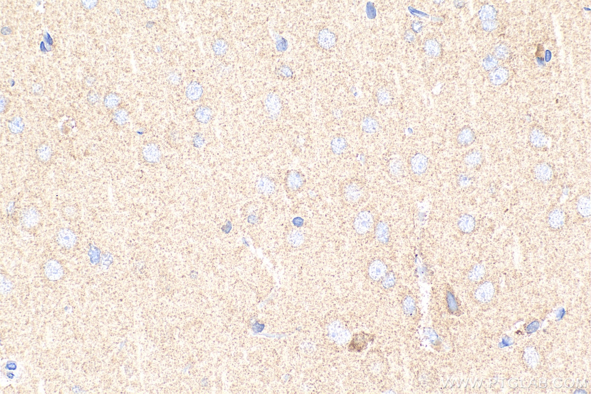 Immunohistochemistry (IHC) staining of rat brain tissue using KCNMA1 Polyclonal antibody (22158-1-AP)