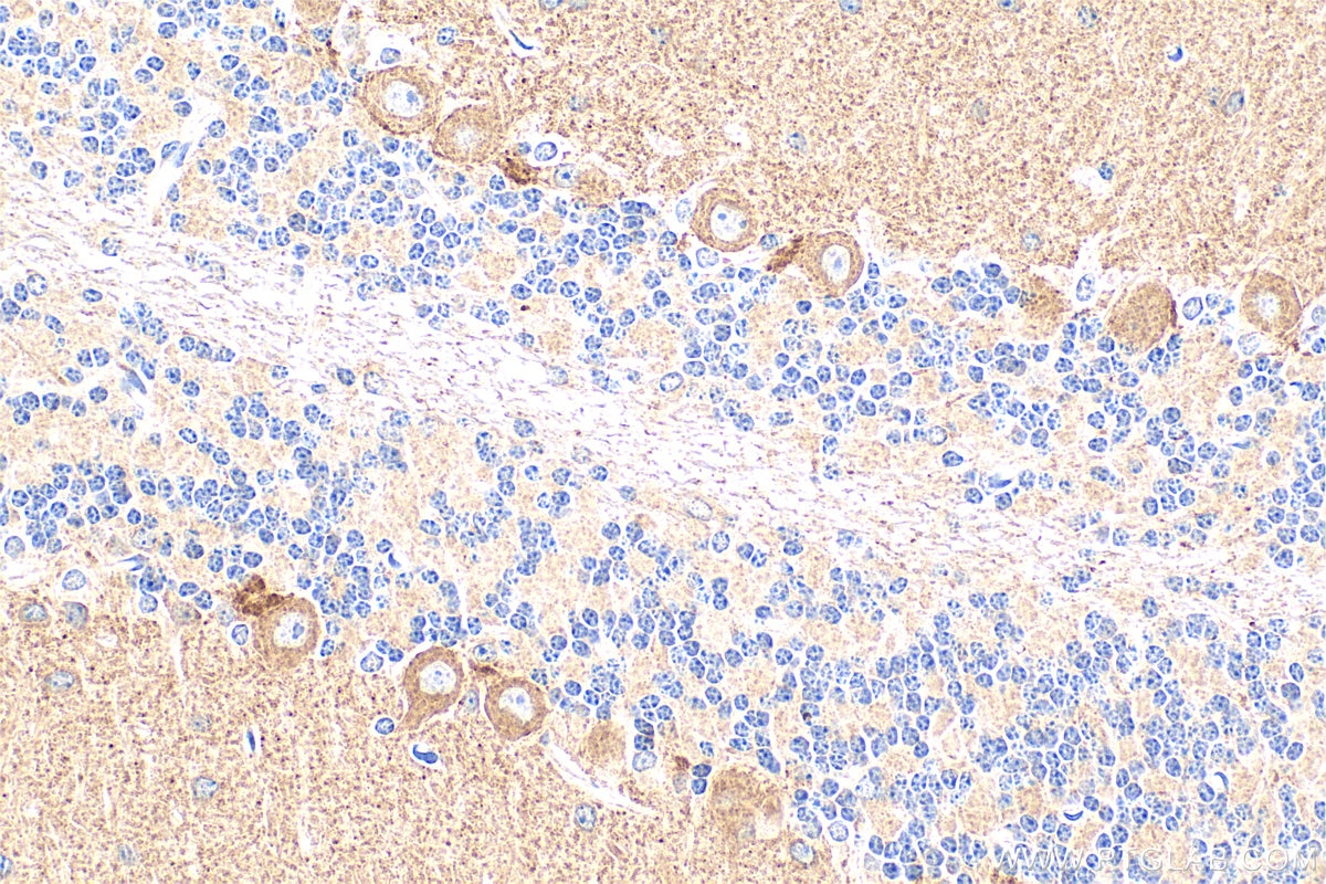 Immunohistochemistry (IHC) staining of mouse cerebellum tissue using KCNMA1 Polyclonal antibody (22158-1-AP)