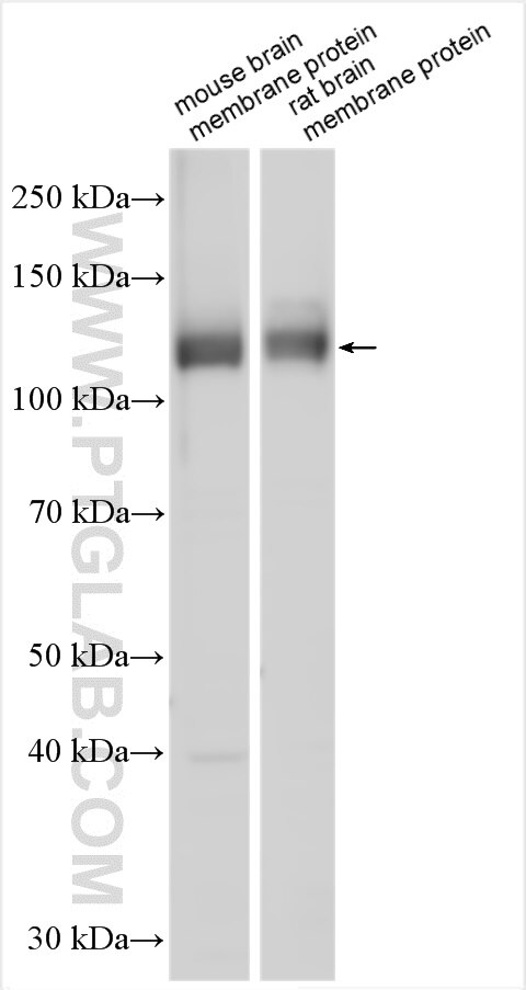 Western Blot (WB) analysis of various lysates using KCNMA1 Polyclonal antibody (22158-1-AP)
