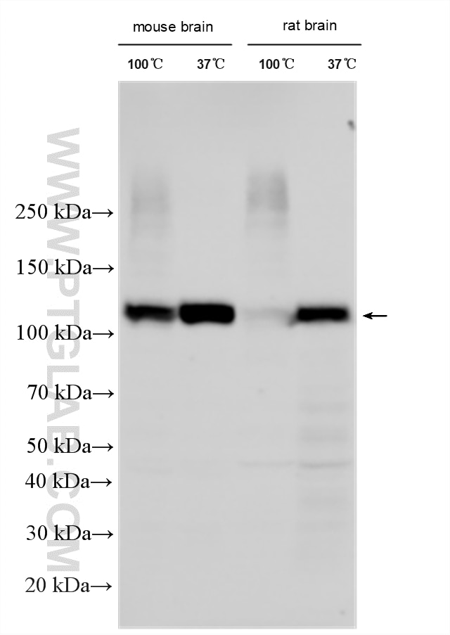 Western Blot (WB) analysis of various lysates using KCNMA1 Polyclonal antibody (22158-1-AP)