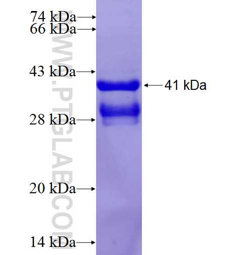 KCNMB1 fusion protein Ag3888 SDS-PAGE