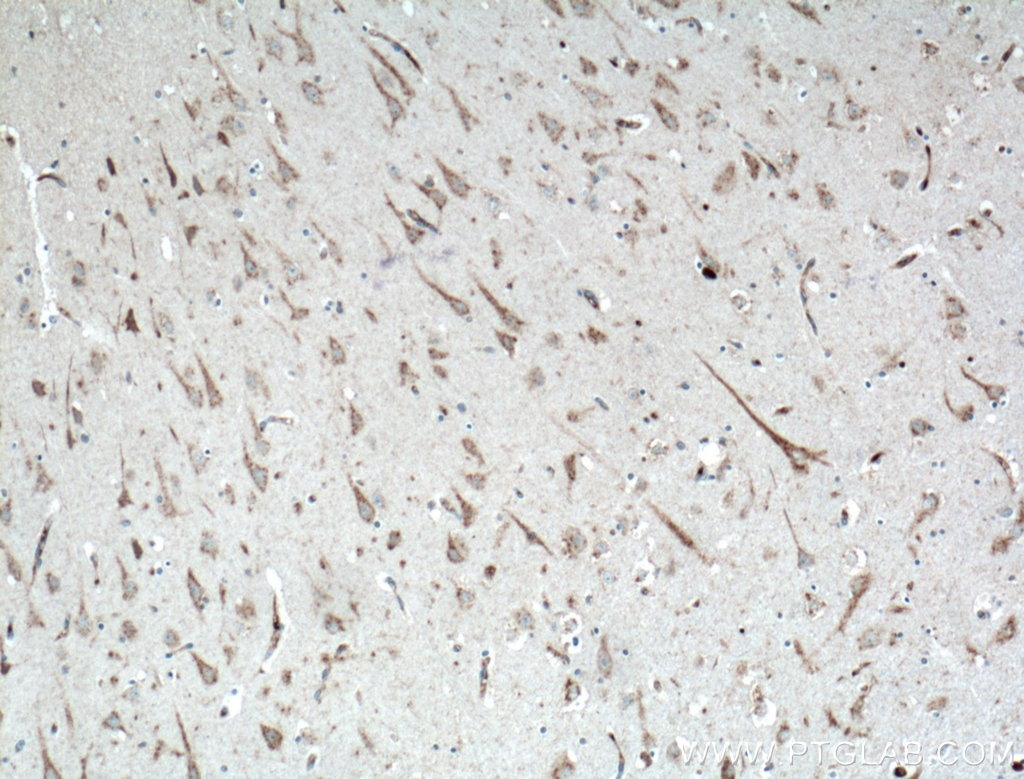 IHC staining of human brain using 16606-1-AP