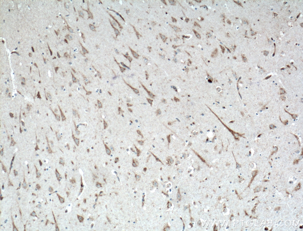 Immunohistochemistry (IHC) staining of human brain tissue using KCNMB2 Polyclonal antibody (16606-1-AP)