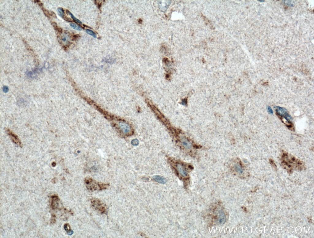 Immunohistochemistry (IHC) staining of human brain tissue using KCNMB2 Polyclonal antibody (16606-1-AP)