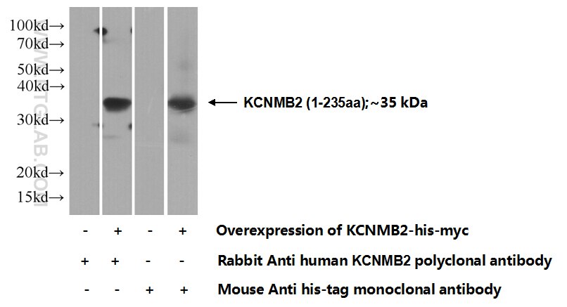 KCNMB2