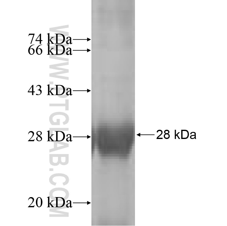 KCNMB2 fusion protein Ag9793 SDS-PAGE