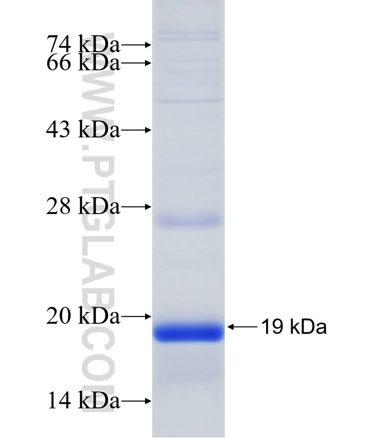 KCNMB3 fusion protein Ag31765 SDS-PAGE
