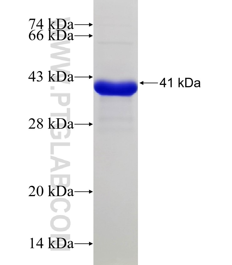 KCNMB3 fusion protein Ag31781 SDS-PAGE