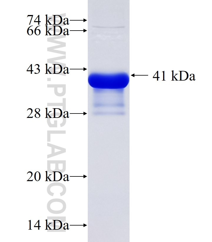 KCNMB3 fusion protein Ag34903 SDS-PAGE KCNMB3 fusion protein Ag34903 SDS-PAGE