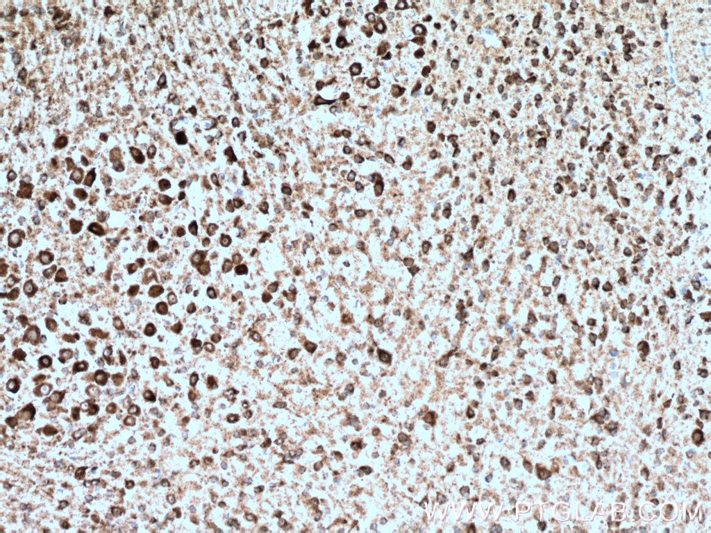 Immunohistochemistry (IHC) staining of mouse brain tissue using KCNMB4 Monoclonal antibody (60122-1-Ig)