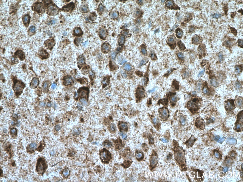Immunohistochemistry (IHC) staining of mouse brain tissue using KCNMB4 Monoclonal antibody (60122-1-Ig)
