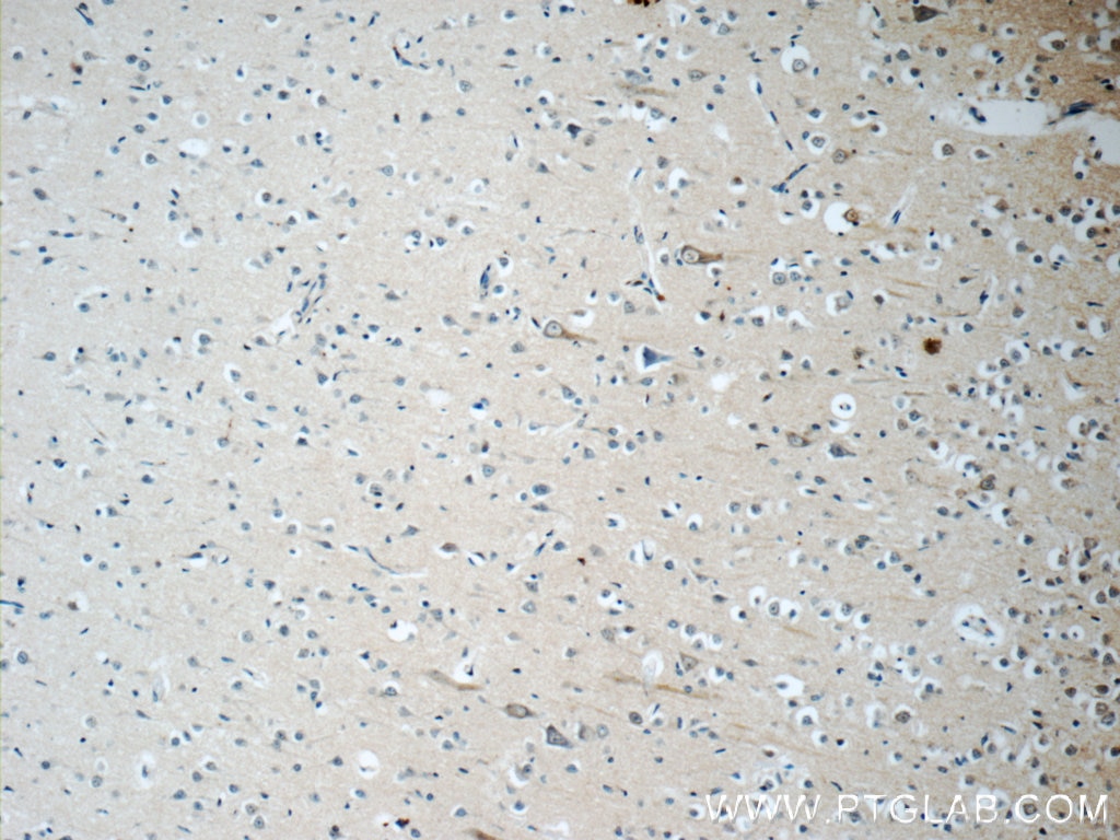 Immunohistochemistry (IHC) staining of human brain tissue using KCNMB4 Monoclonal antibody (60122-1-Ig)