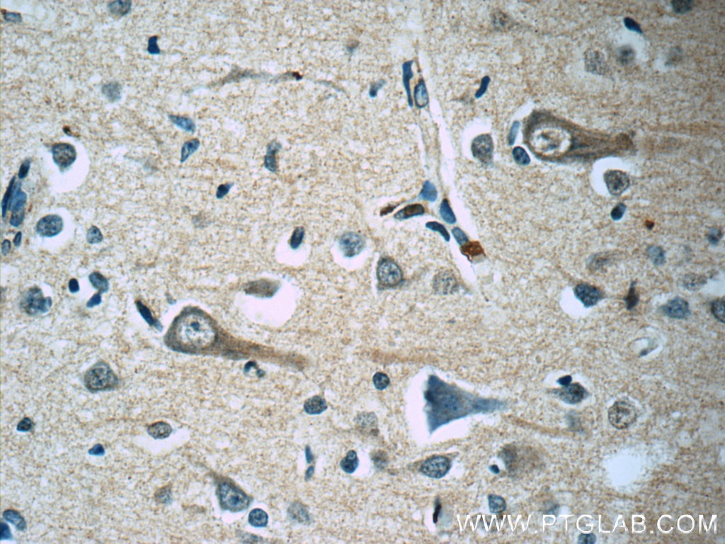 Immunohistochemistry (IHC) staining of human brain tissue using KCNMB4 Monoclonal antibody (60122-1-Ig)