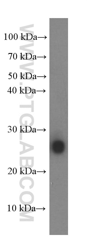 Western Blot (WB) analysis of fetal human brain tissue using KCNMB4 Monoclonal antibody (60122-1-Ig)