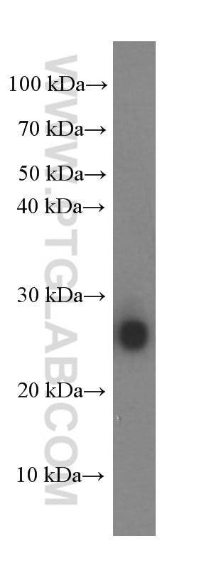 WB analysis of fetal human brain using 60122-1-Ig