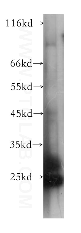 Western Blot (WB) analysis of human brain tissue using KCNMB4 Monoclonal antibody (60122-1-Ig)