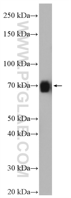 Western Blot (WB) analysis of mouse brain tissue using KCNN1 Polyclonal antibody (17929-1-AP)