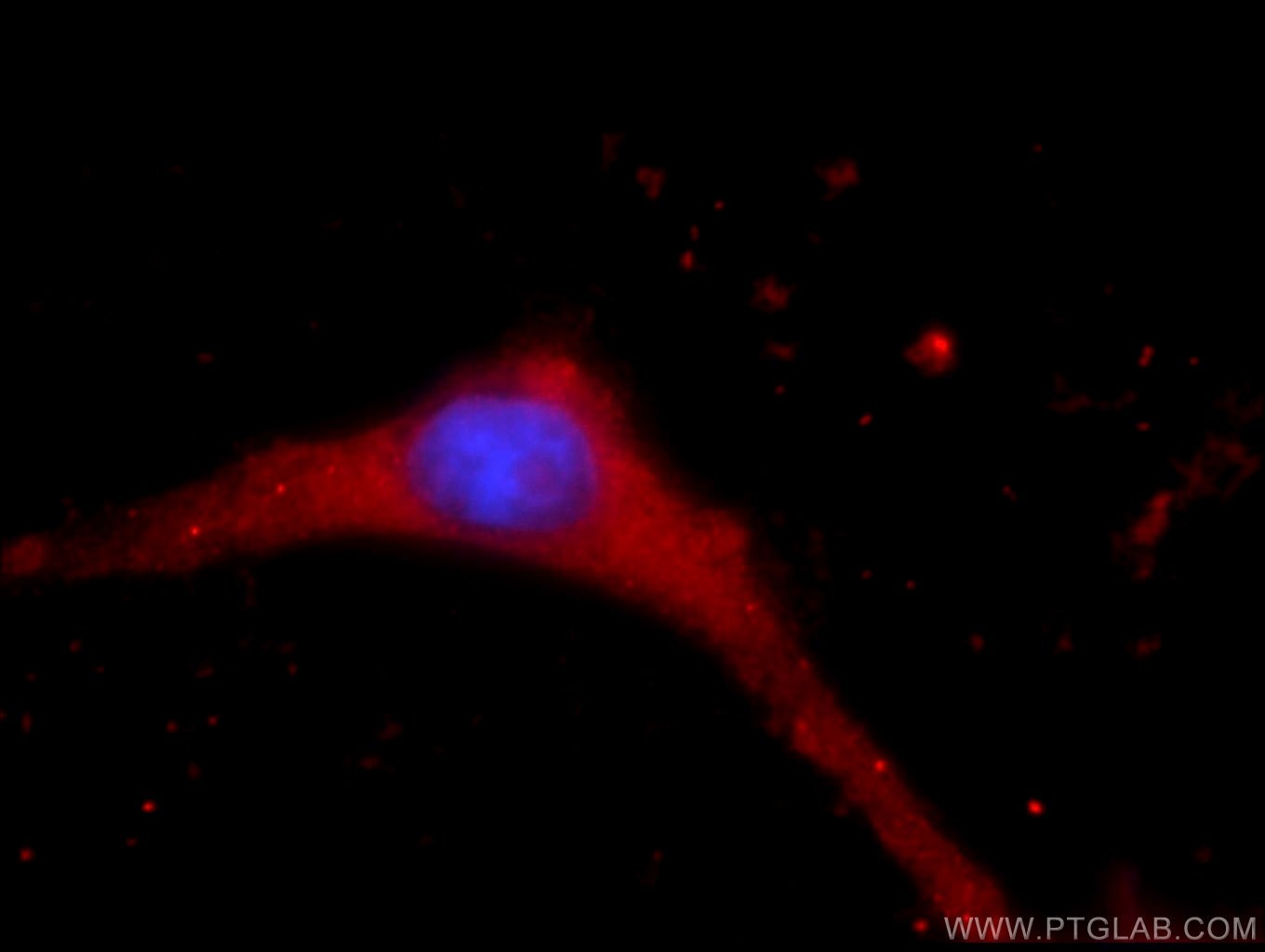 Immunofluorescence (IF) / fluorescent staining of SH-SY5Y cells using KCNN3 Polyclonal antibody (17188-1-AP)