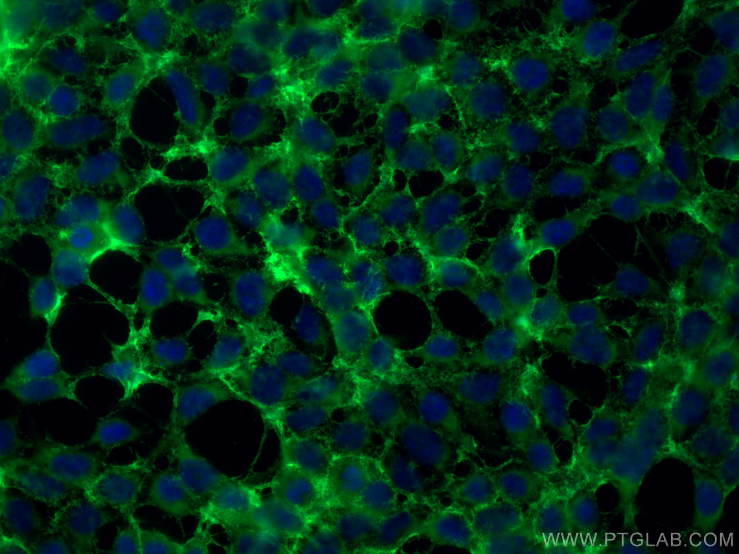 IF Staining of HEK-293 using 23271-1-AP