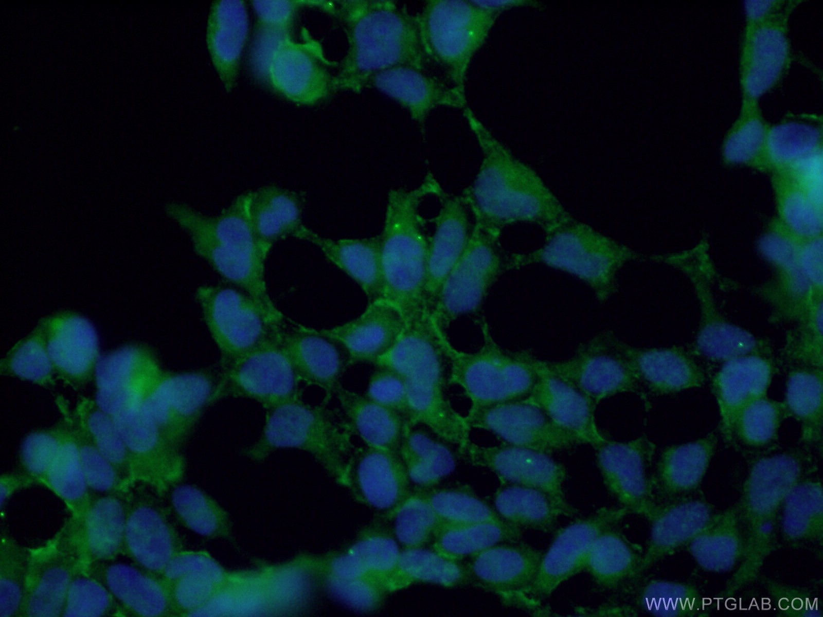 Immunofluorescence (IF) / fluorescent staining of HEK-293 cells using KCNN4 Polyclonal antibody (23271-1-AP)