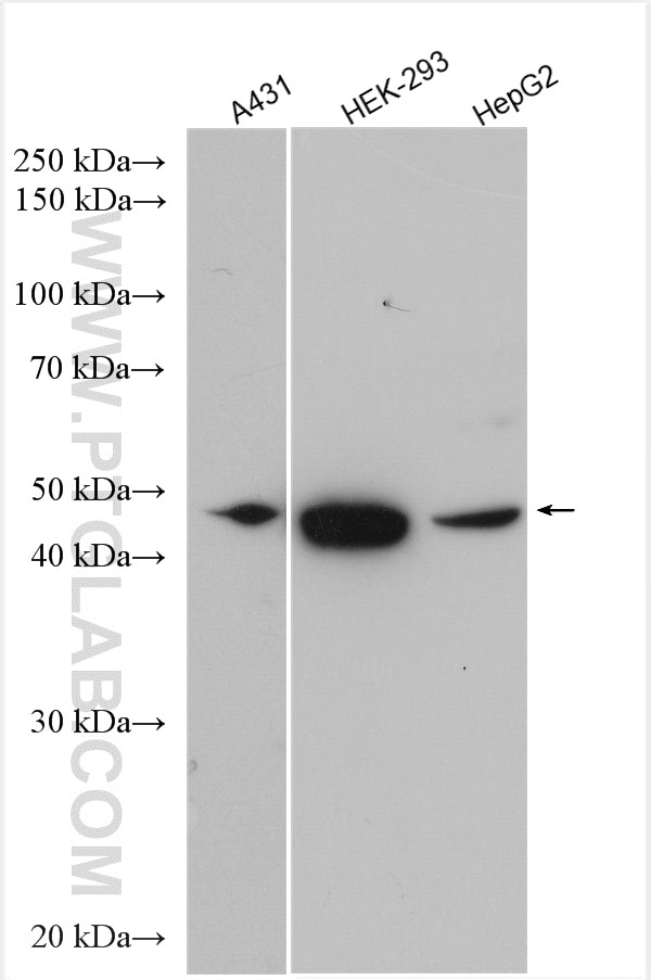 Western Blot (WB) analysis of various lysates using KCNN4 Polyclonal antibody (23271-1-AP)