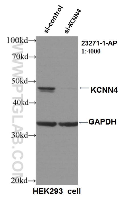 Western Blot (WB) analysis of HEK-293 cells using KCNN4 Polyclonal antibody (23271-1-AP)