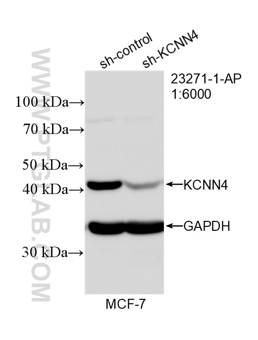 Western Blot (WB) analysis of MCF-7 cells using KCNN4 Polyclonal antibody (23271-1-AP)