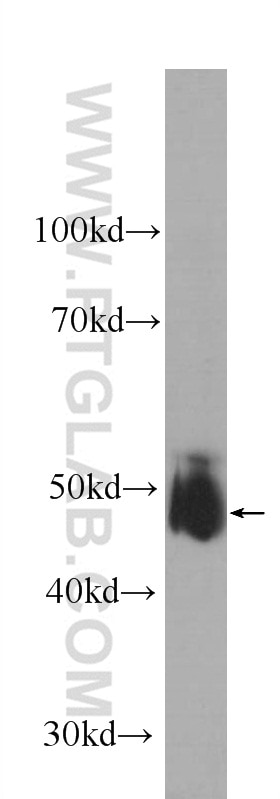 Western Blot (WB) analysis of human blood using KCNN4 Monoclonal antibody (60276-1-Ig)