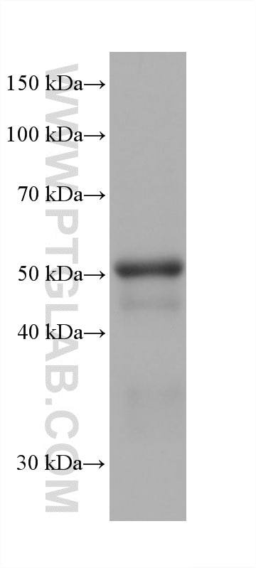 WB analysis of MCF-7 using 60276-1-Ig Western Blot (WB) analysis of MCF-7 cells using KCNN4 Monoclonal antibody (60276-1-Ig)