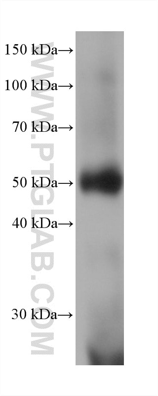 WB analysis of human blood using 60276-1-Ig Western Blot (WB) analysis of human blood using KCNN4 Monoclonal antibody (60276-1-Ig)