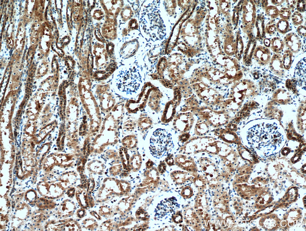Immunohistochemistry (IHC) staining of human kidney tissue using KCNQ1DN Polyclonal antibody (21233-1-AP)