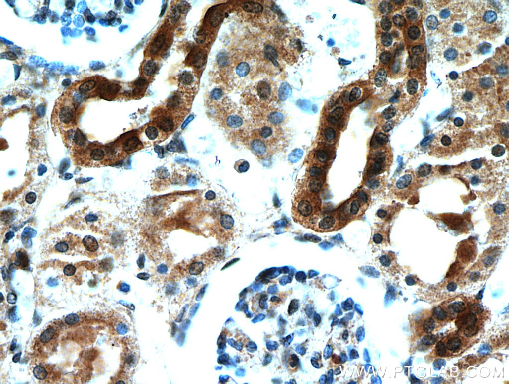 Immunohistochemistry (IHC) staining of human kidney tissue using KCNQ1DN Polyclonal antibody (21233-1-AP)