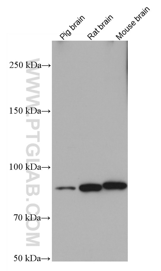 Western Blot (WB) analysis of various lysates using KCNQ2 Monoclonal antibody (66774-1-Ig)