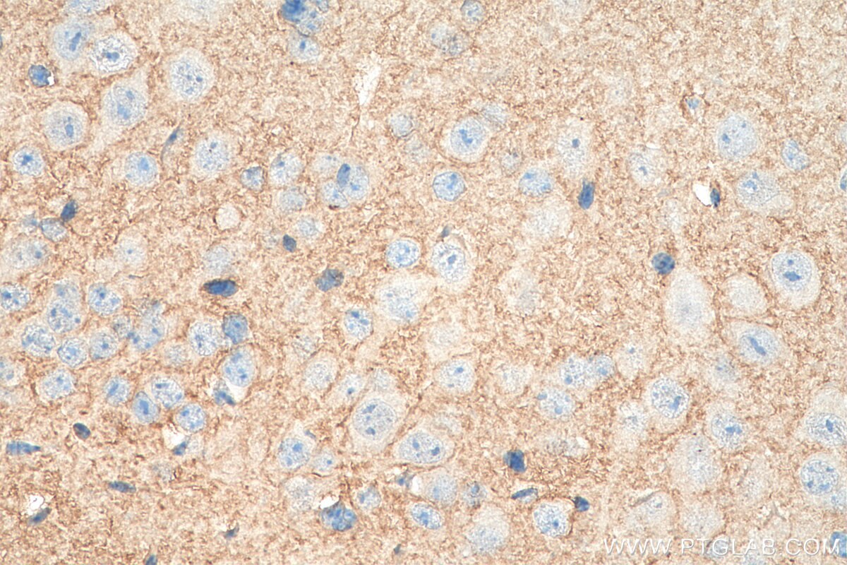 Immunohistochemistry (IHC) staining of mouse brain tissue using KCNQ3 Polyclonal antibody (19966-1-AP)