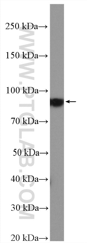 Western Blot (WB) analysis of pig heart tissue using KCNQ3 Polyclonal antibody (19966-1-AP)